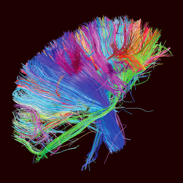 The Beauty of Brain Connections